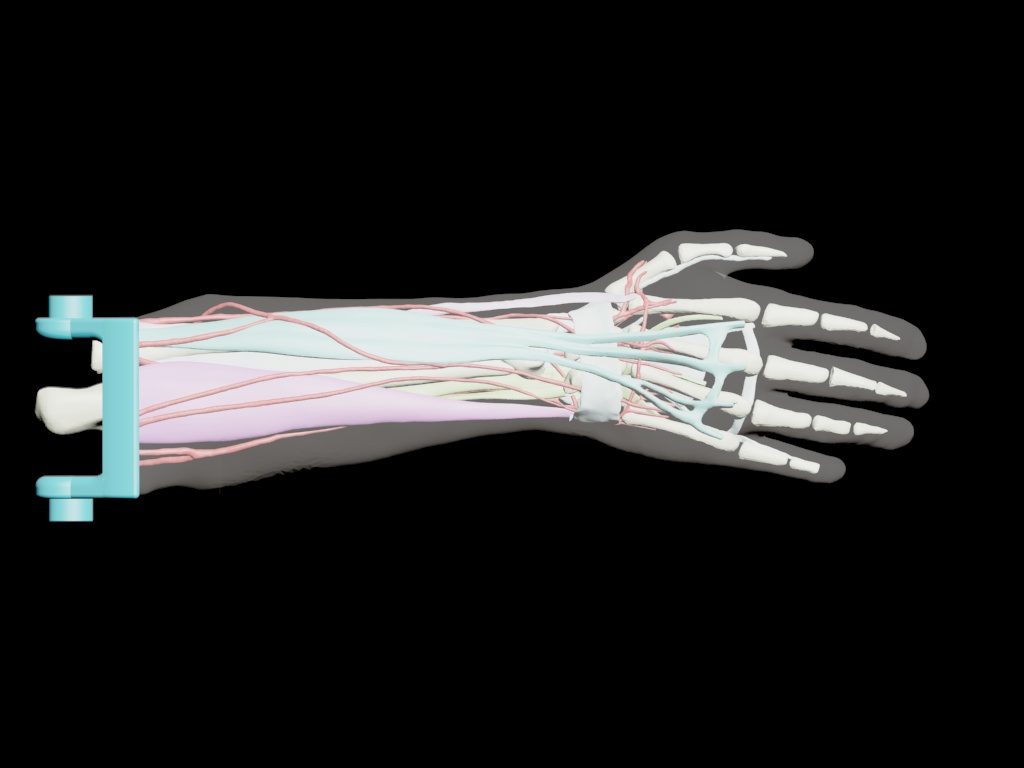 Adult Arm (Complex) design