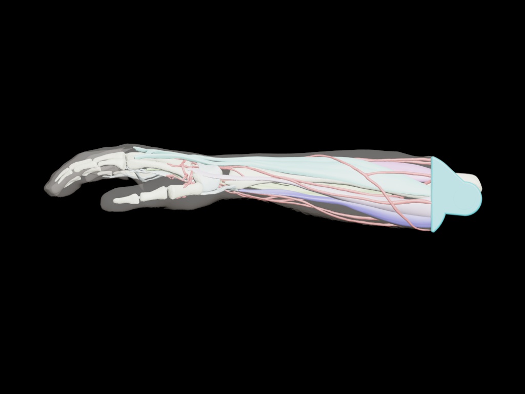 Adult Arm (Complex) design