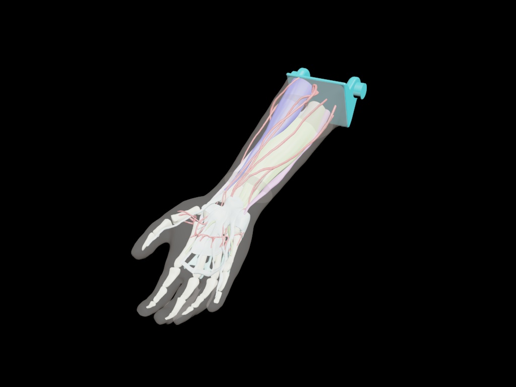 Adult Arm (Complex) design