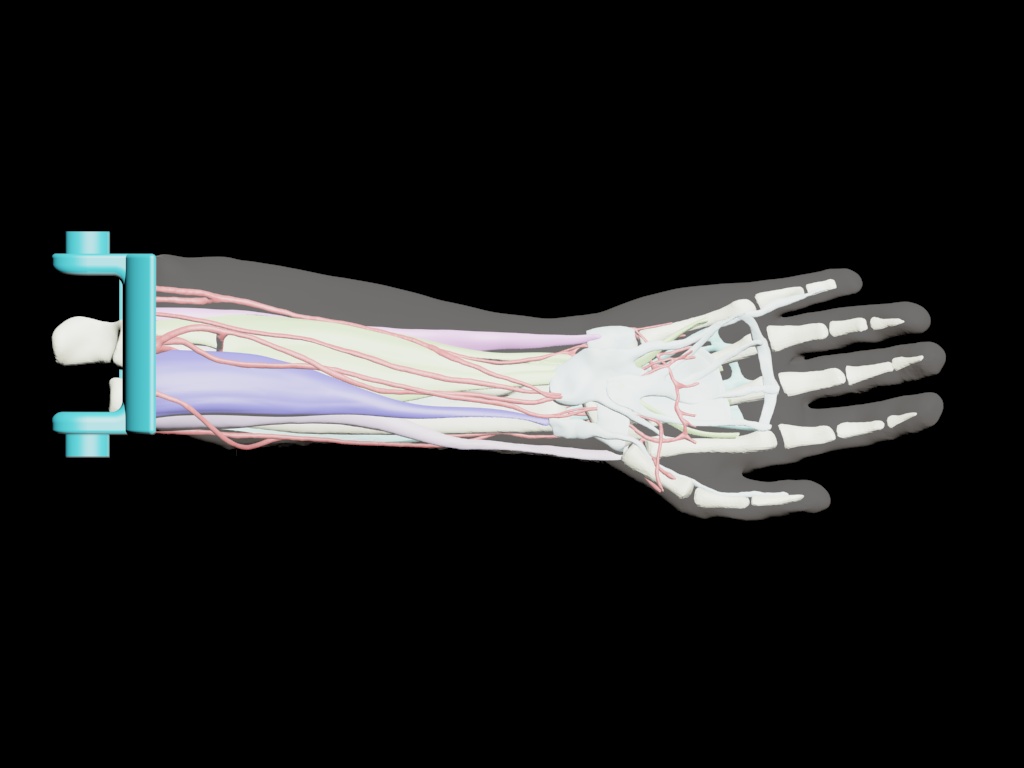 Adult Arm (Complex) design