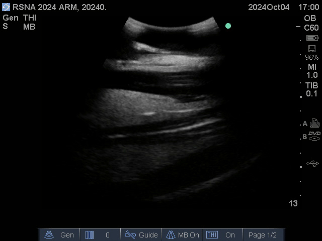 Muscles & Bones (Sagittal)