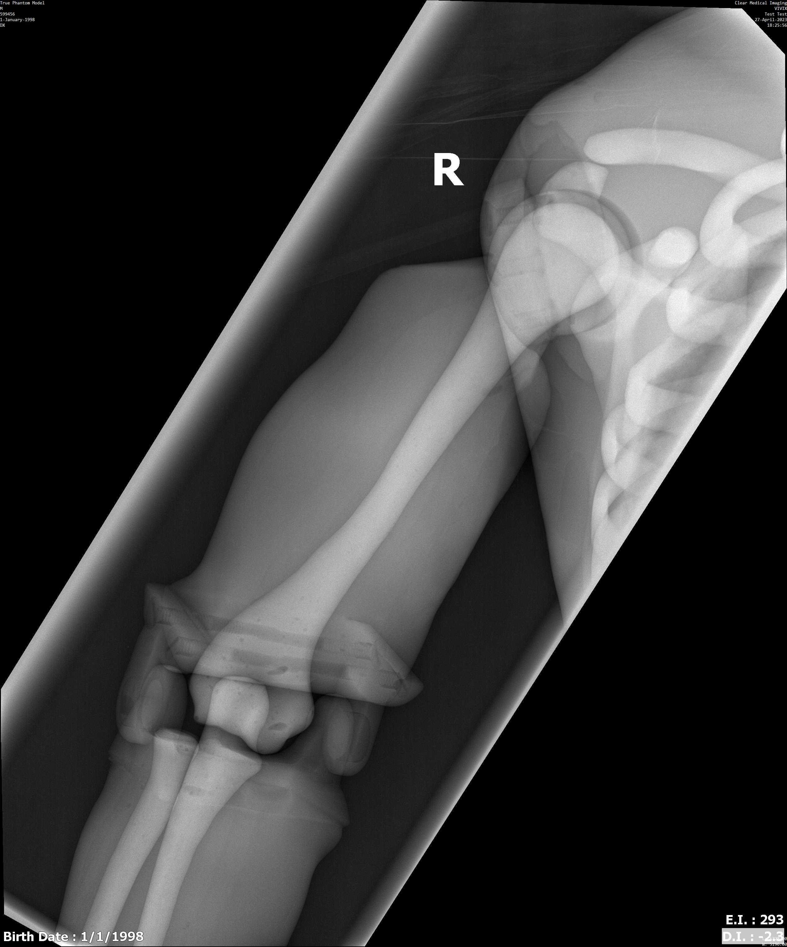 X-Ray Scans