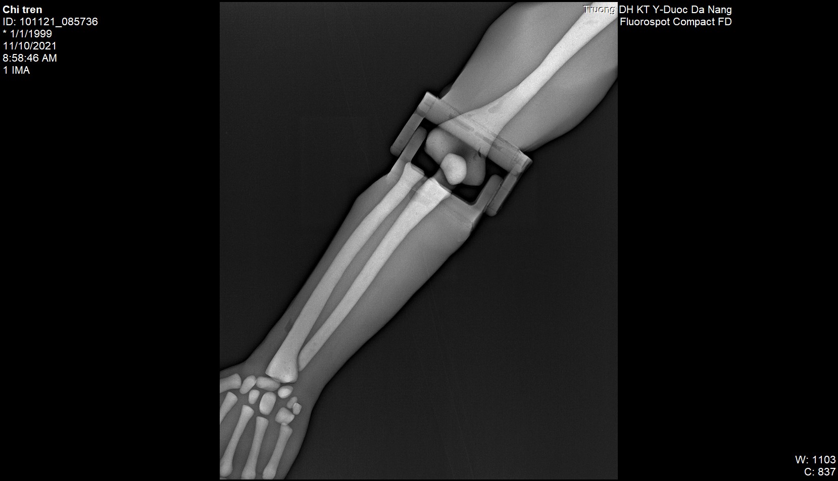 X-Ray Scans