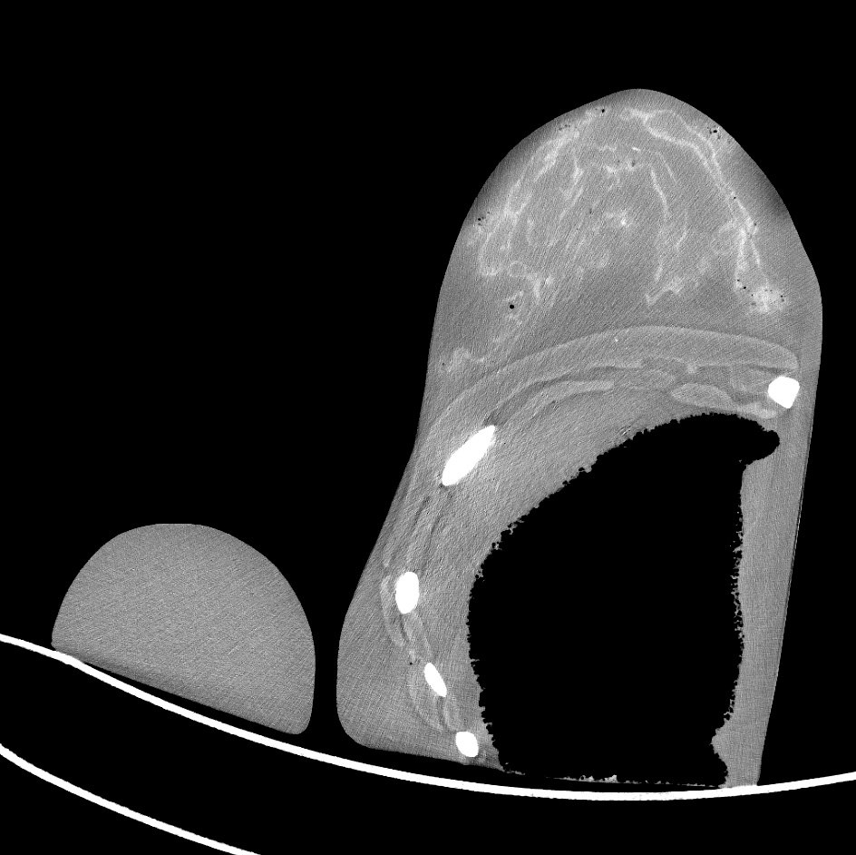 CT Scans