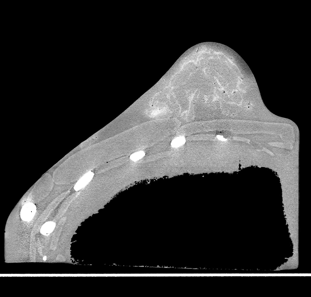 CT Scans