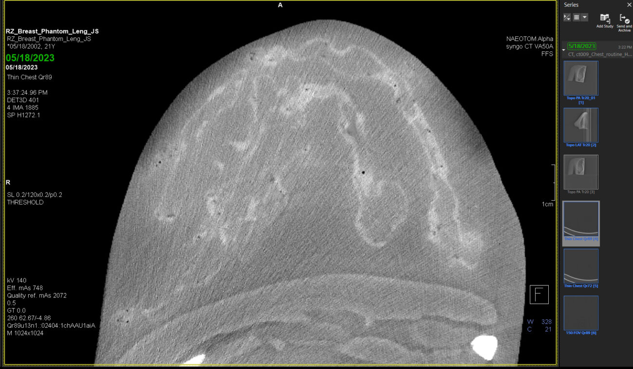 X-Ray Scans