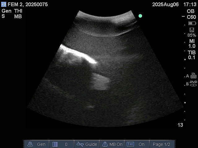 Ultrasound Scans