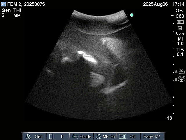 Ultrasound Scans