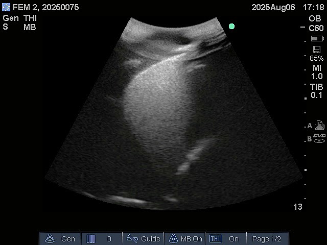 Ultrasound Scans