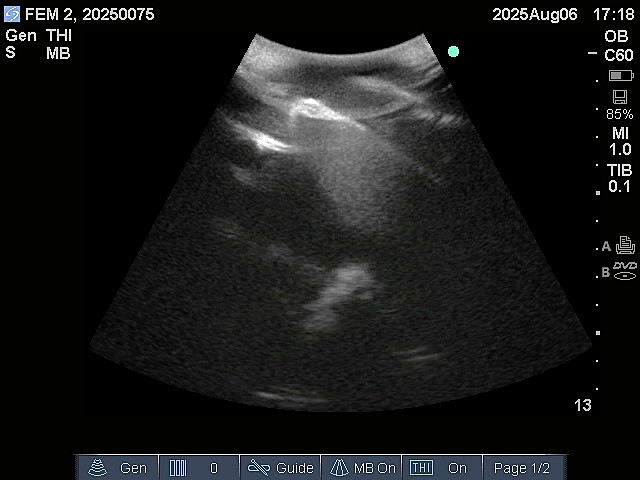 Ultrasound Scans