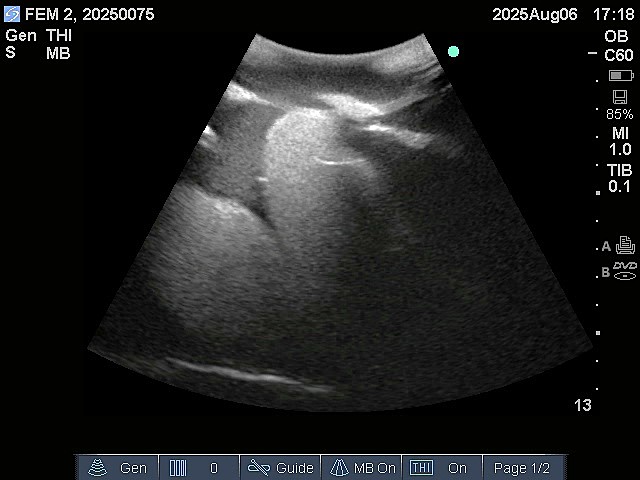 Ultrasound Scans