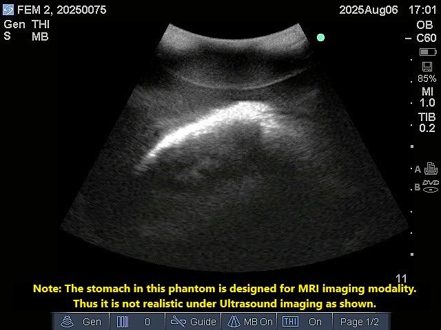 Ultrasound Scans