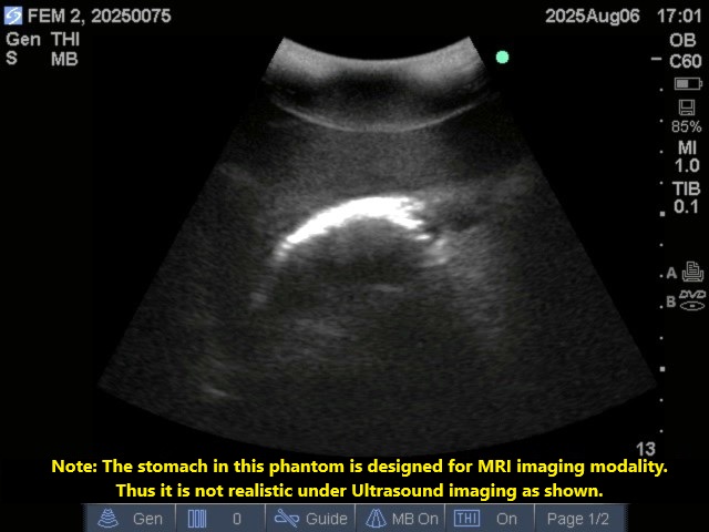 Ultrasound Scans