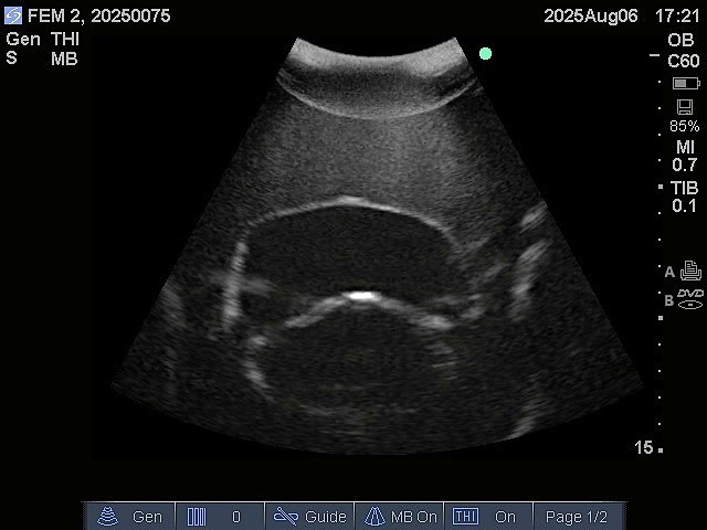 Ultrasound Scans