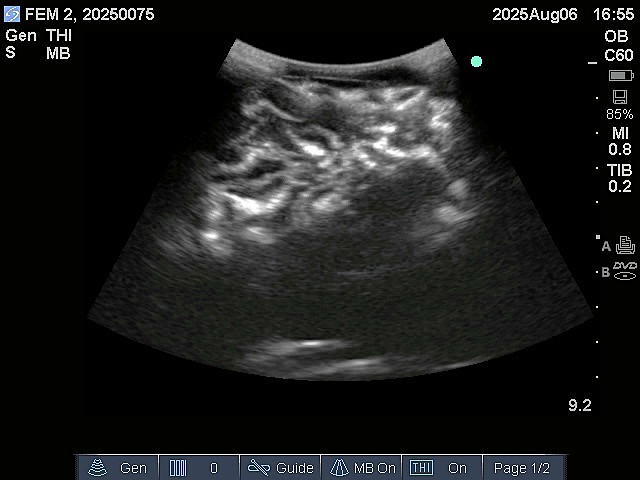 Ultrasound Scans