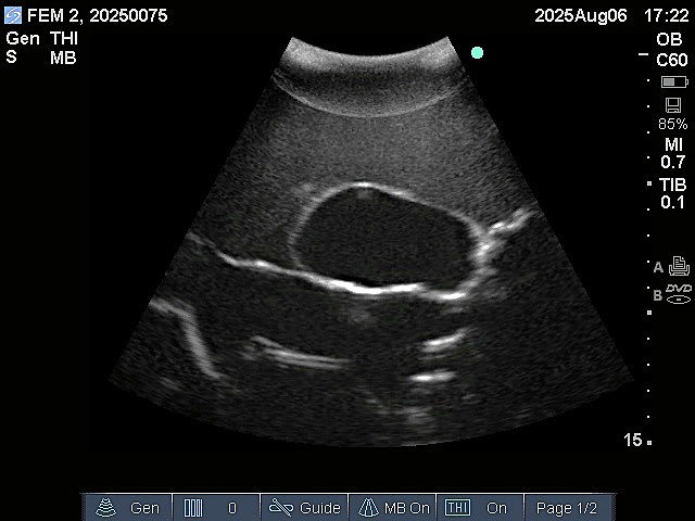 Ultrasound Scans