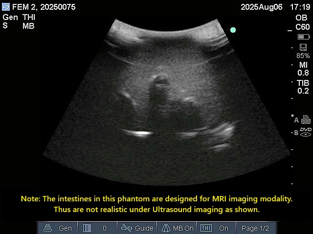 Ultrasound Scans