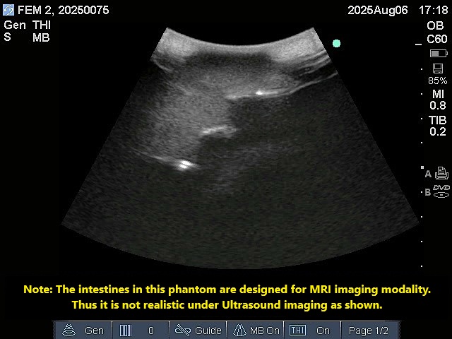 Ultrasound Scans