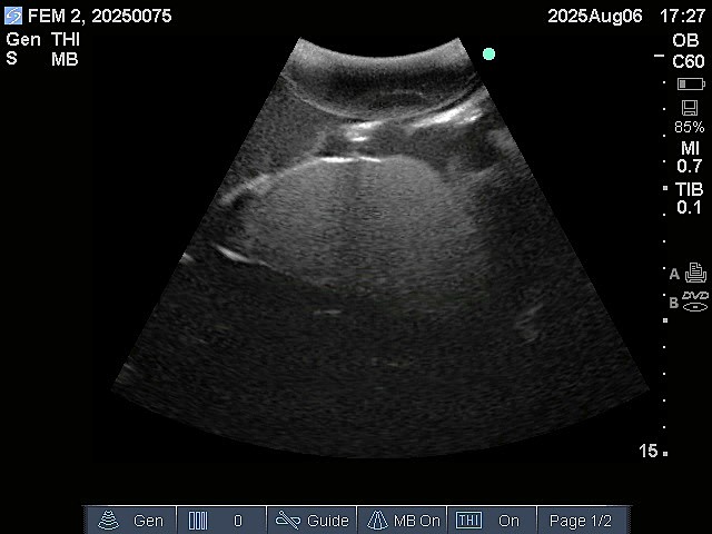 Ultrasound Scans