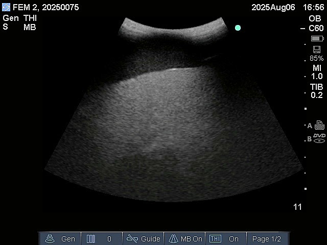 Ultrasound Scans
