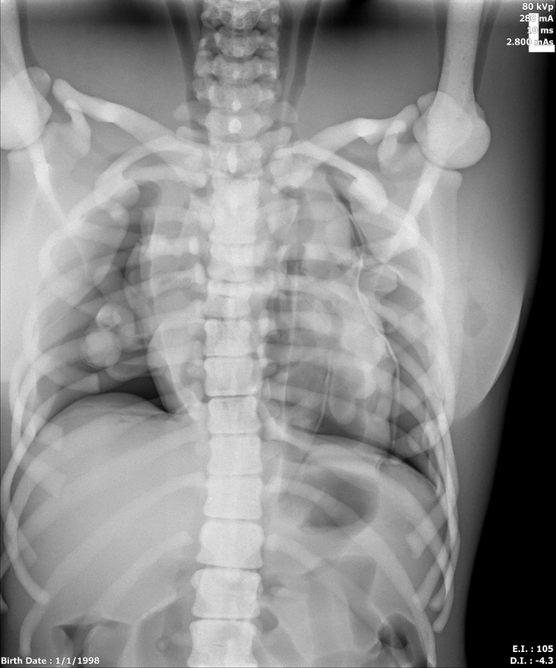 X-Ray Scans