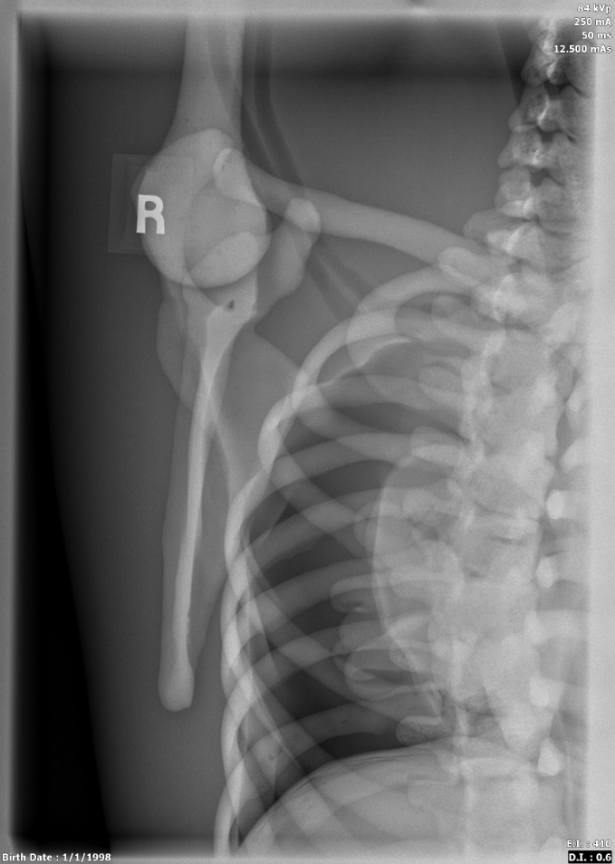 X-Ray Scans