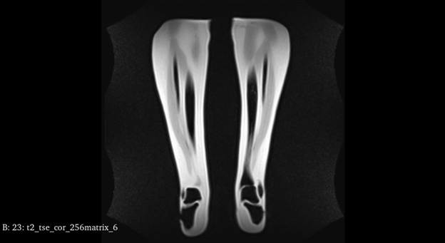 MRI Scans
