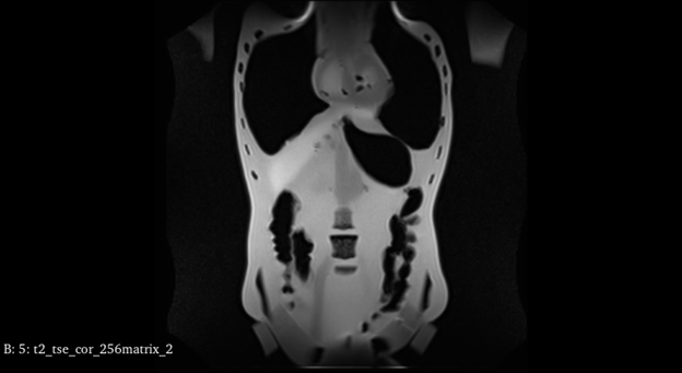 MRI Scans