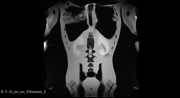 MRI Scans