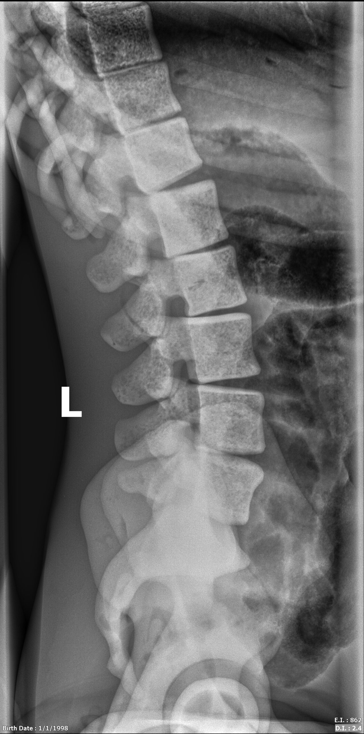 X-Ray Scans