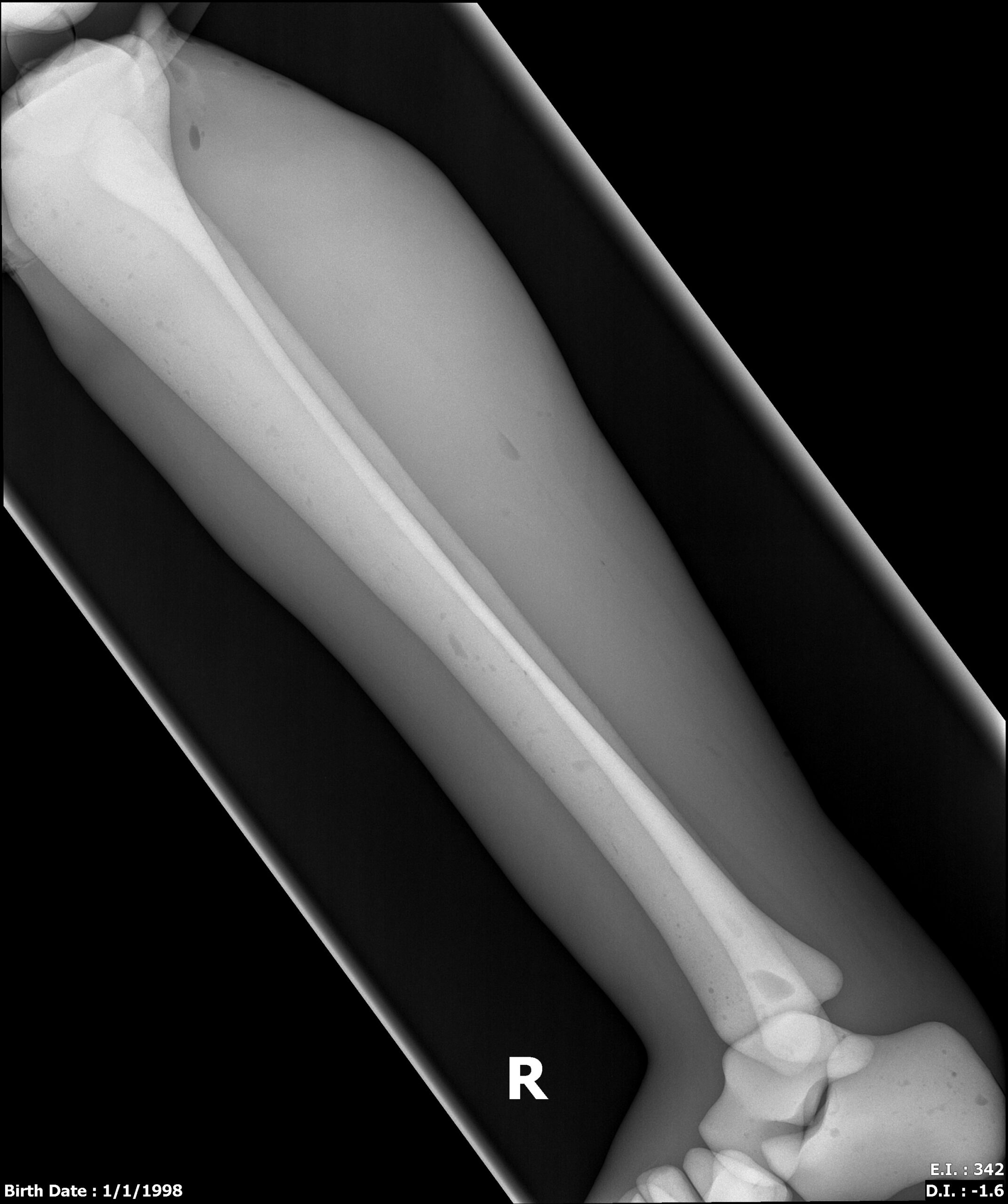 X-Ray Scans