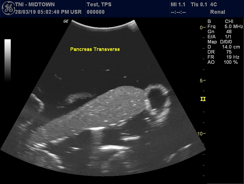 Ultrasound Scans