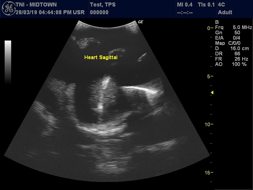 Ultrasound Scans