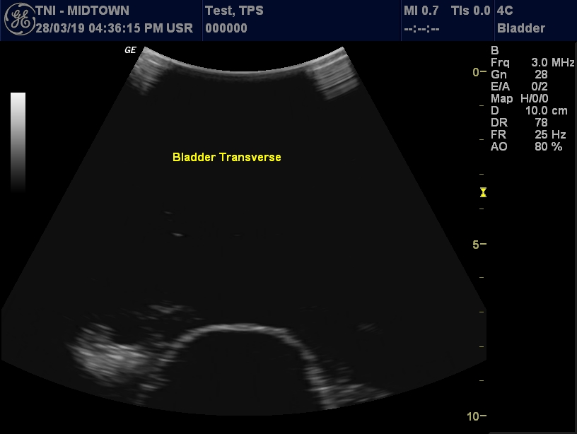 Ultrasound Scans