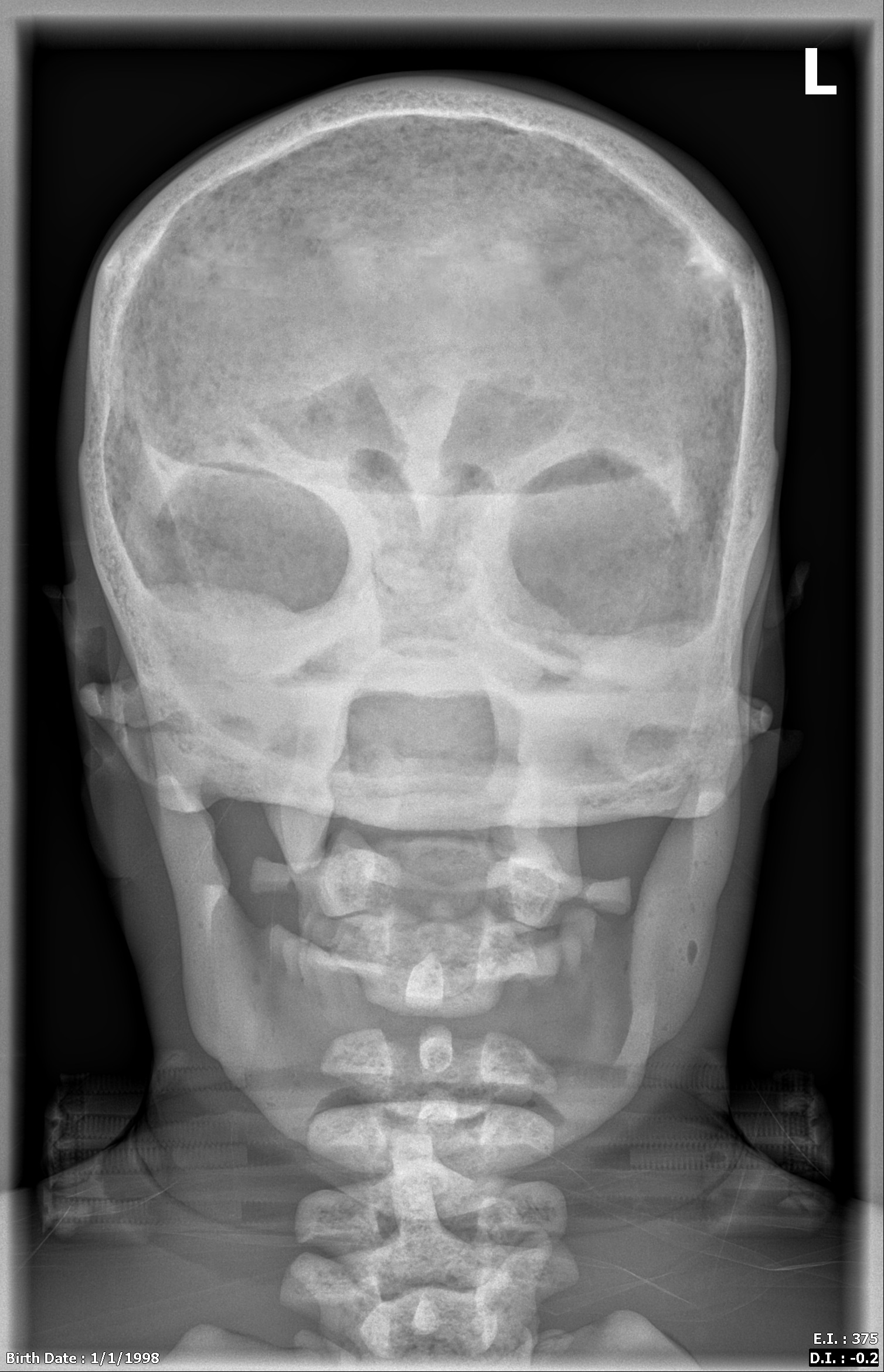 X-Ray Scans