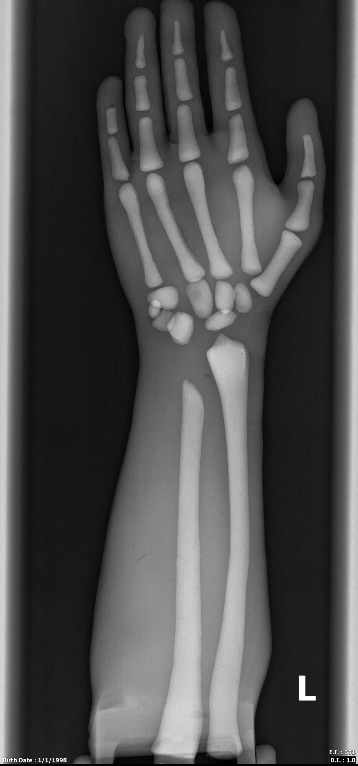 X-Ray Scans