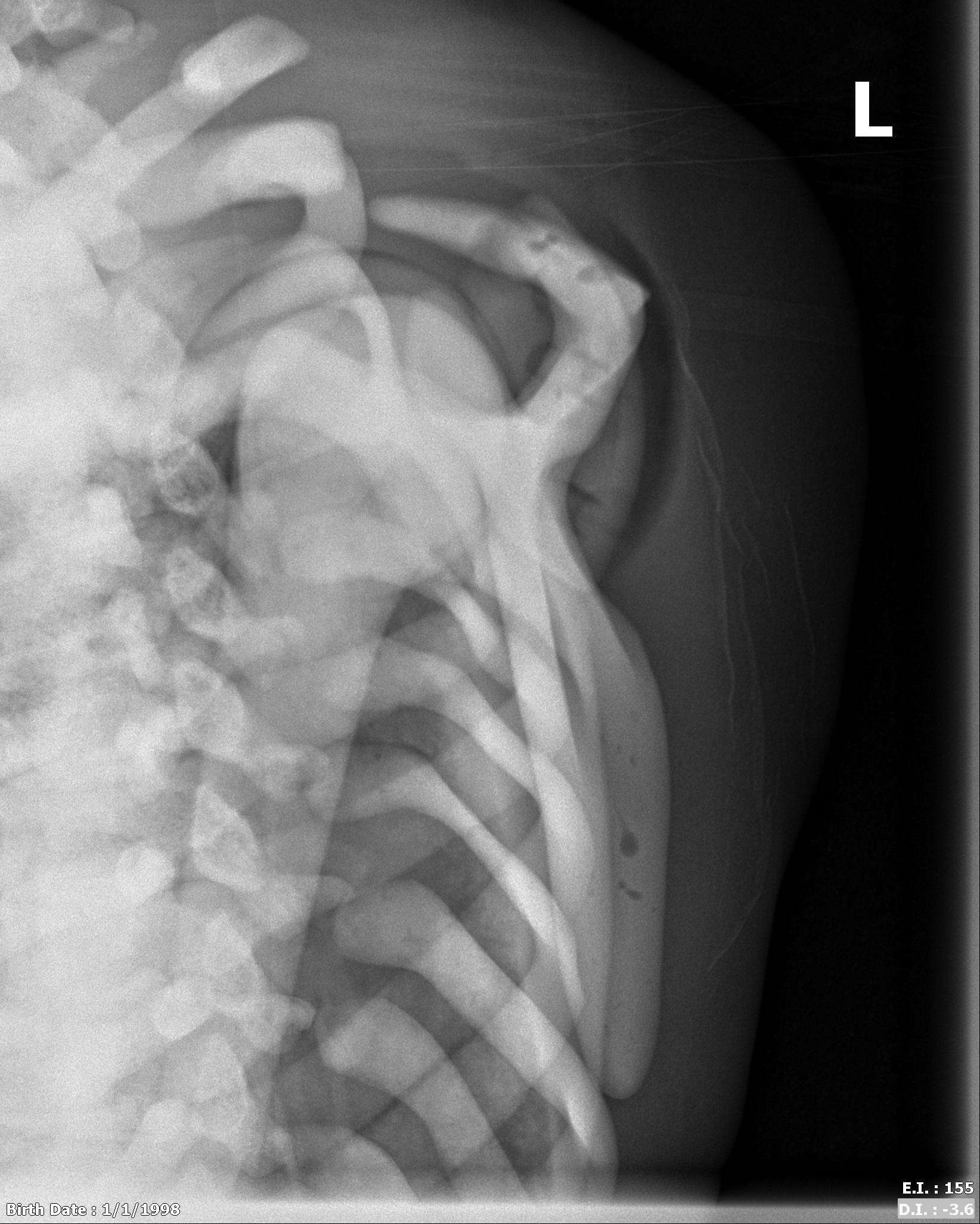 X-Ray Scans