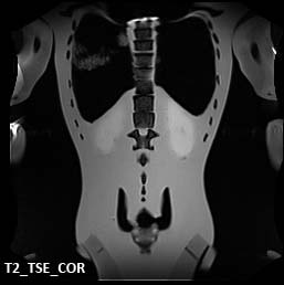 MRI Scans