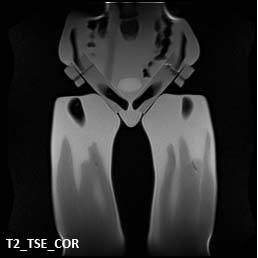 MRI Scans