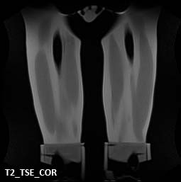 MRI Scans