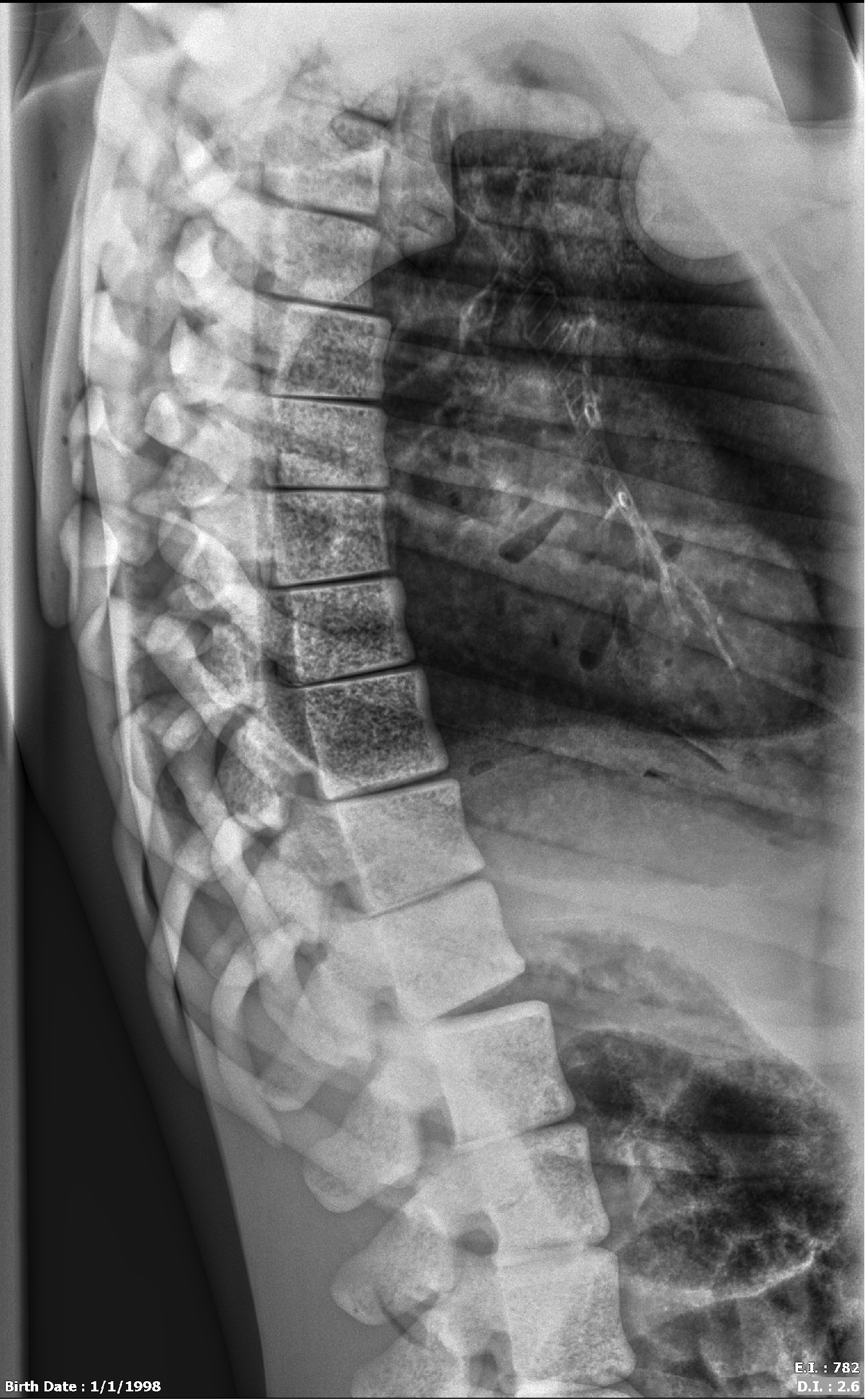 X-Ray Scans