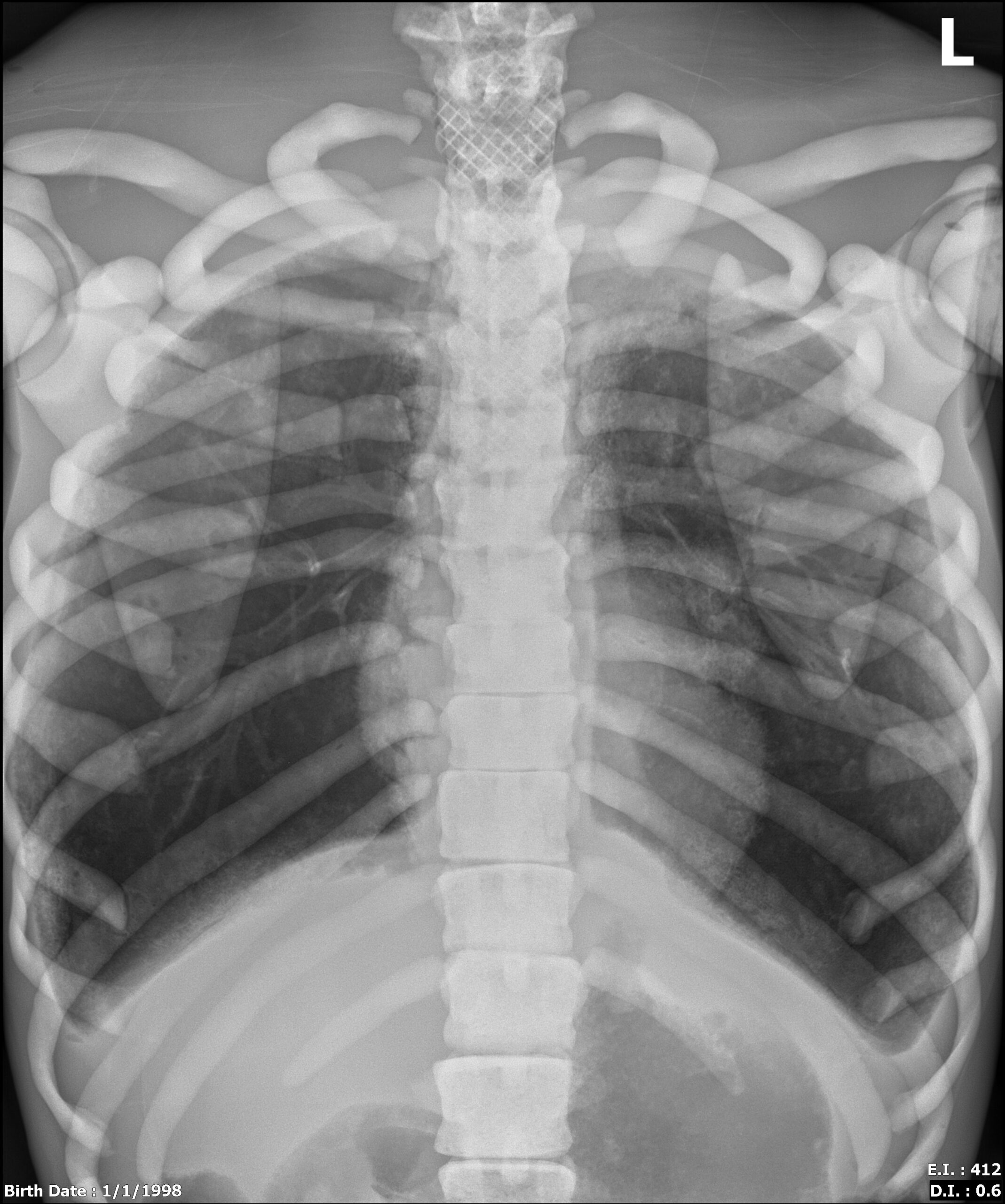 X-Ray Scans