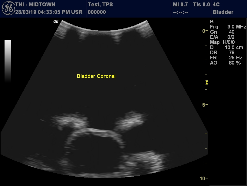 Ultrasound Scans