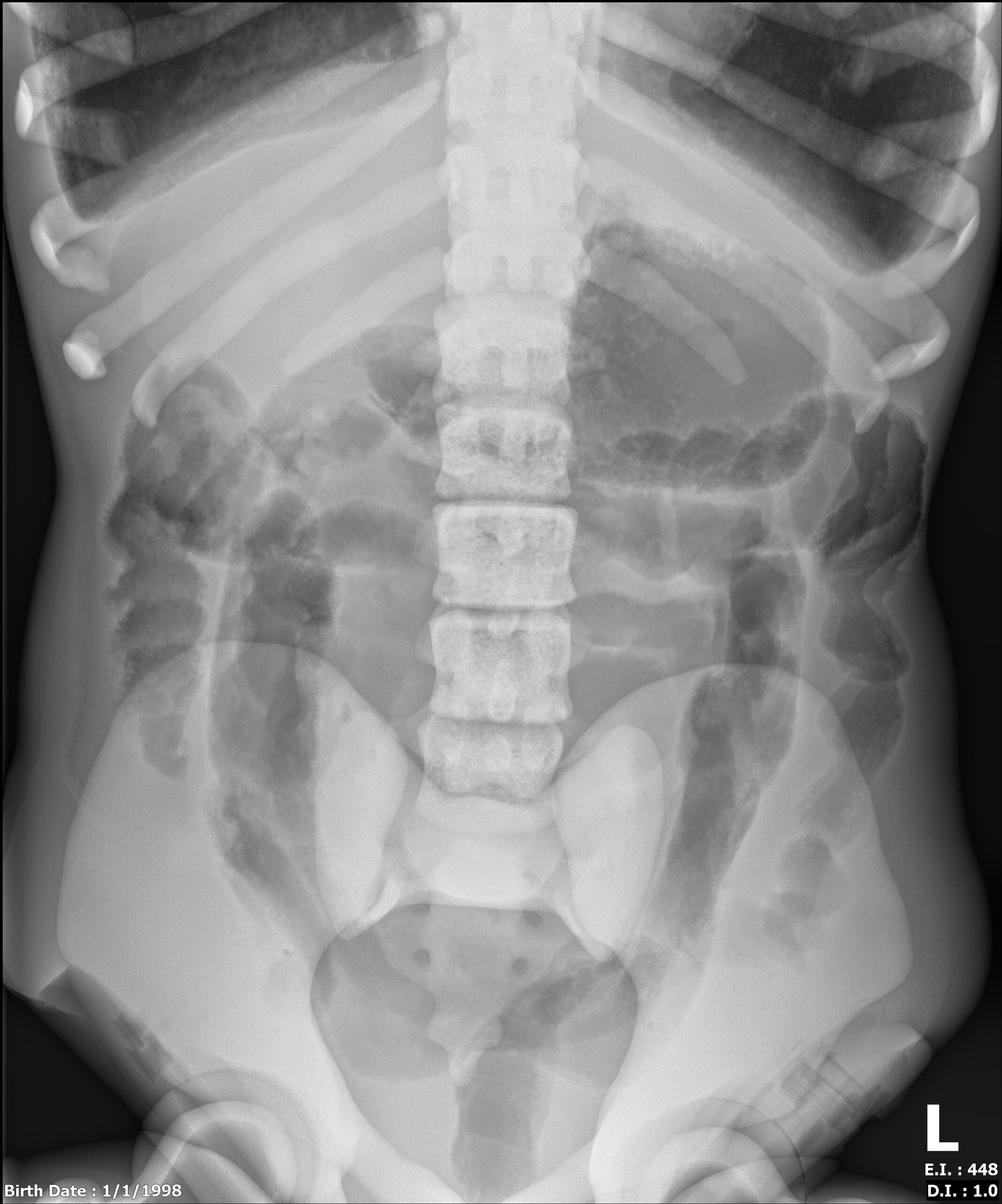 X-Ray Scans