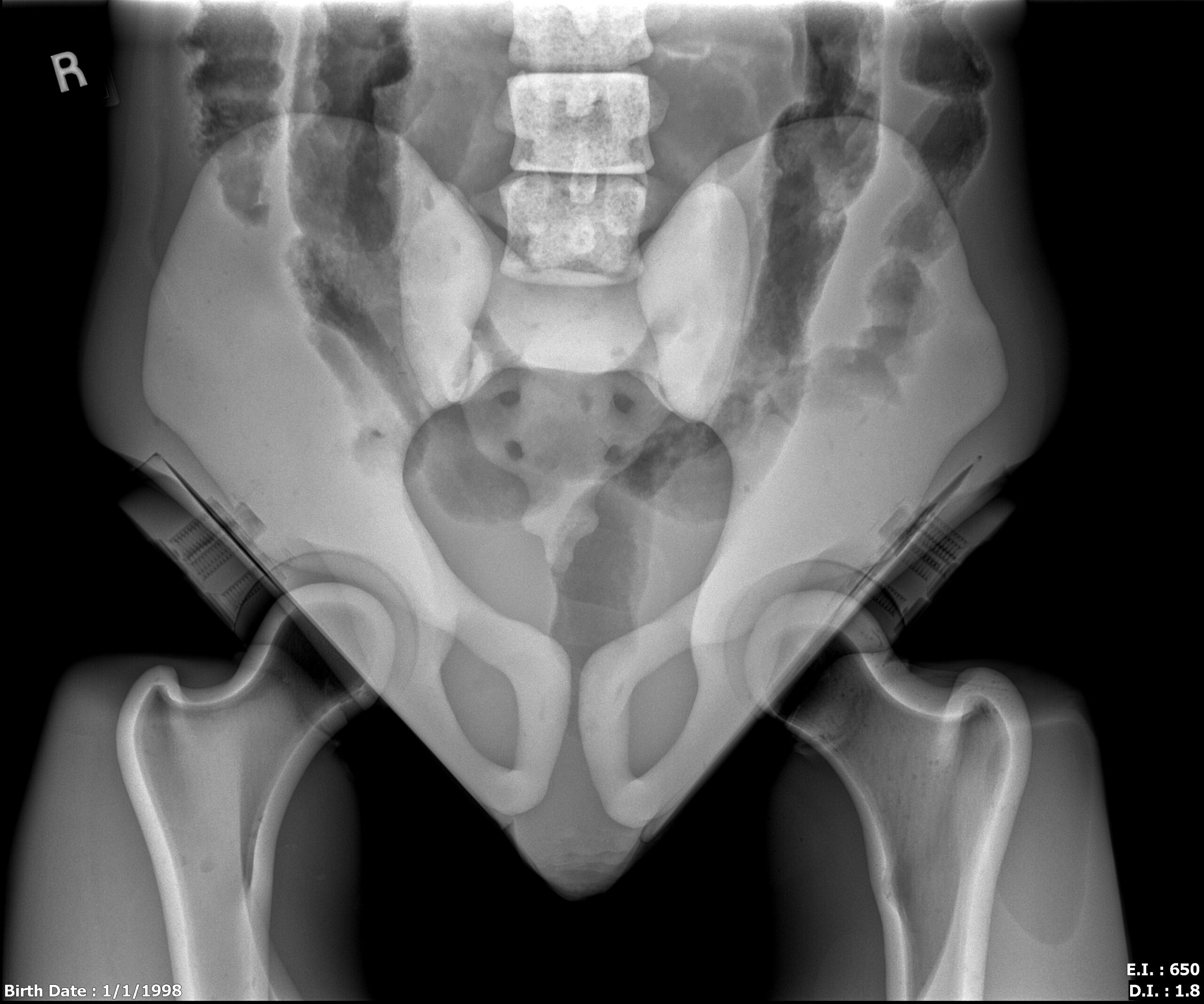 X-Ray Scans