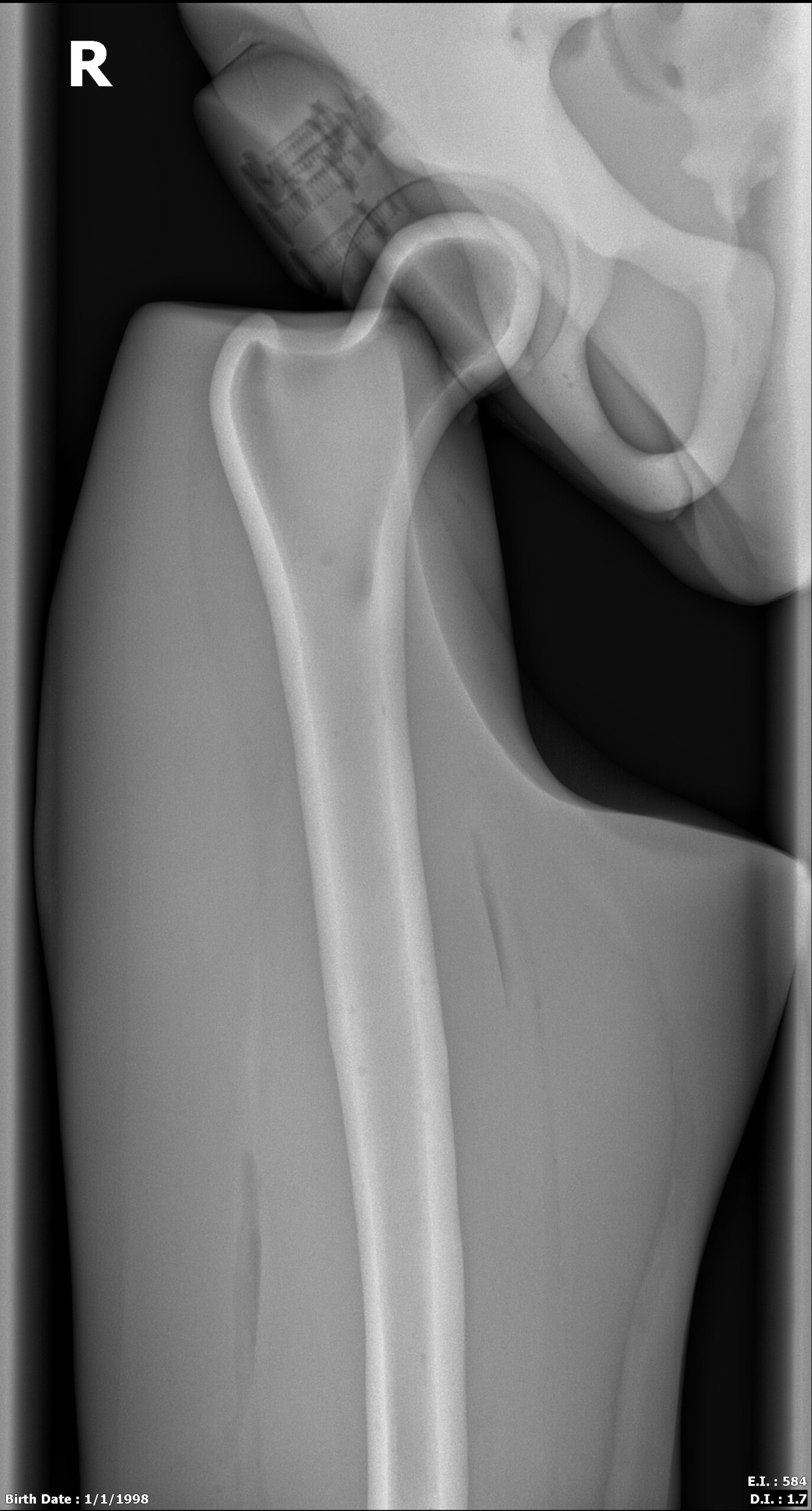 X-Ray Scans