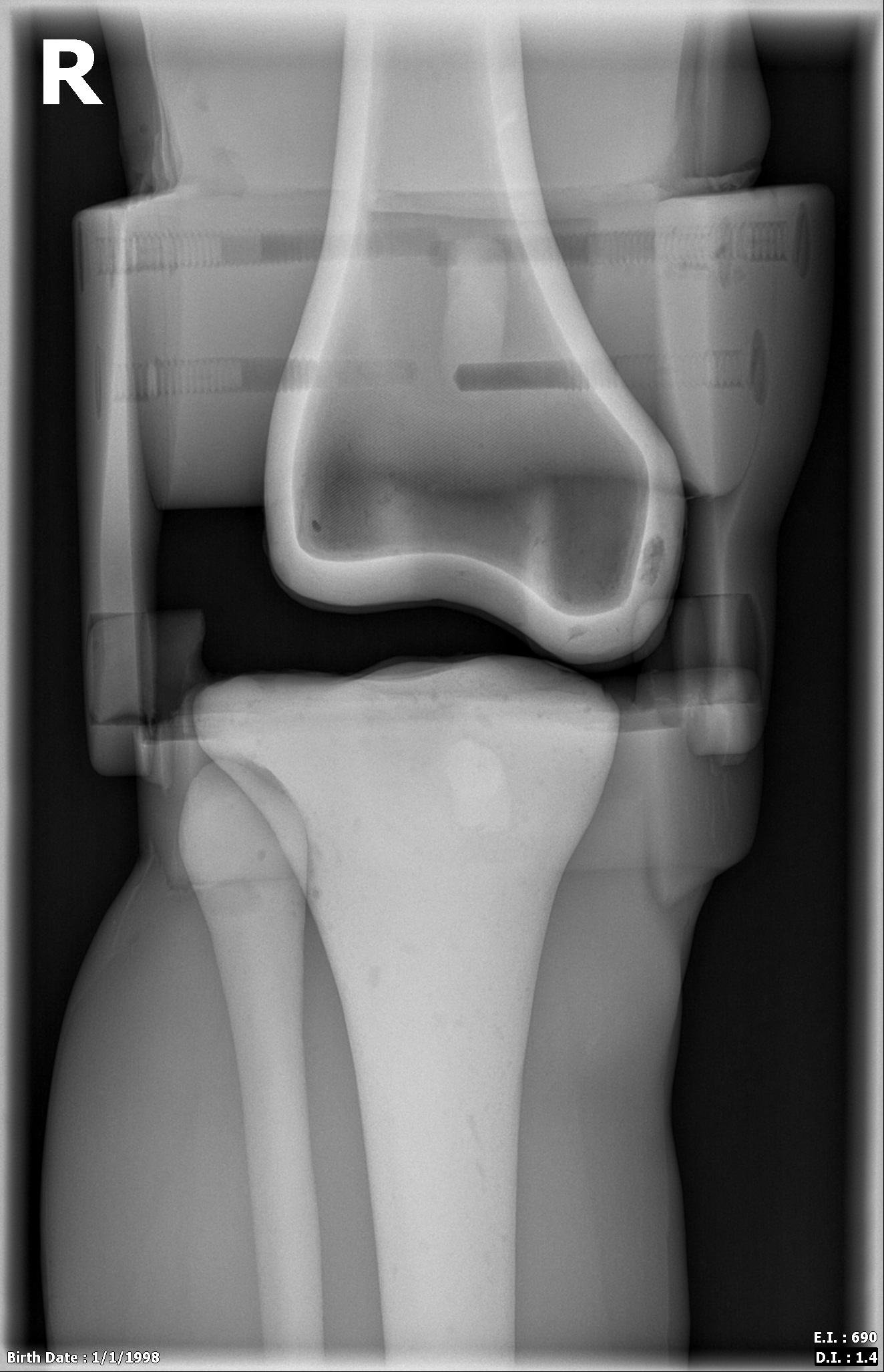 X-Ray Scans