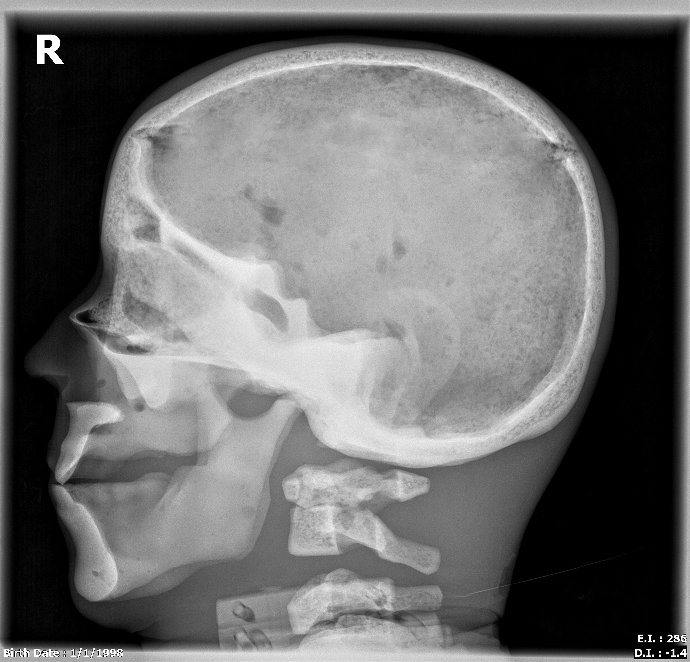 X-Ray Scans