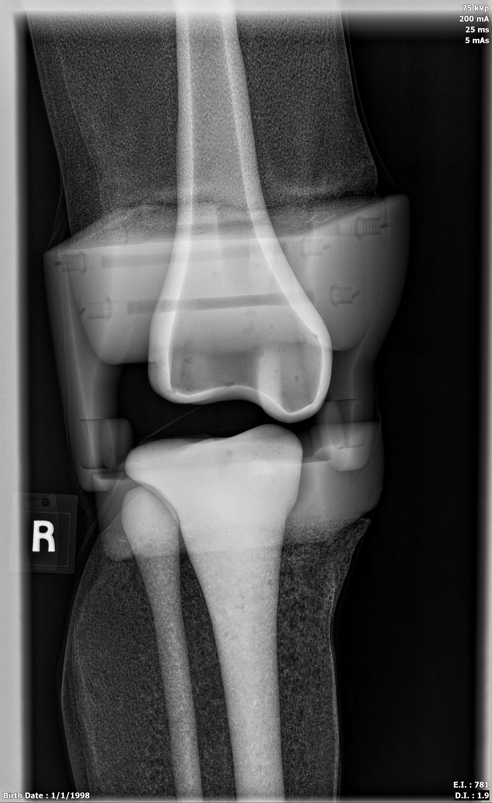 X-Ray Scans