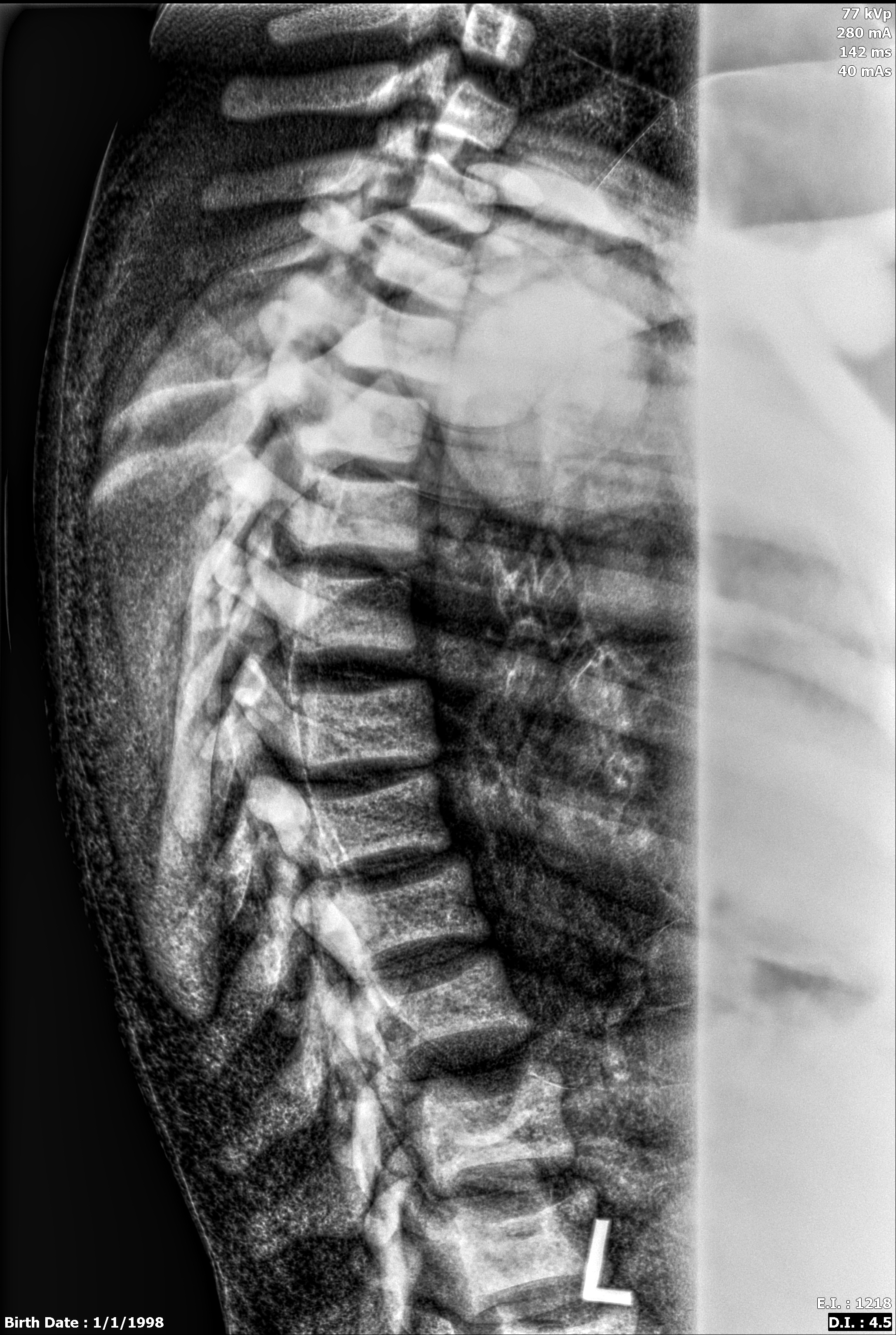 X-Ray Scans